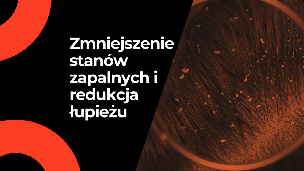 Zmniejszenie stanów zapalnych i redukcja łupieżu